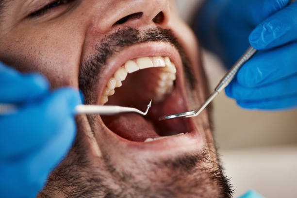Best Weekend Emergency Dental Services in Concord, VA