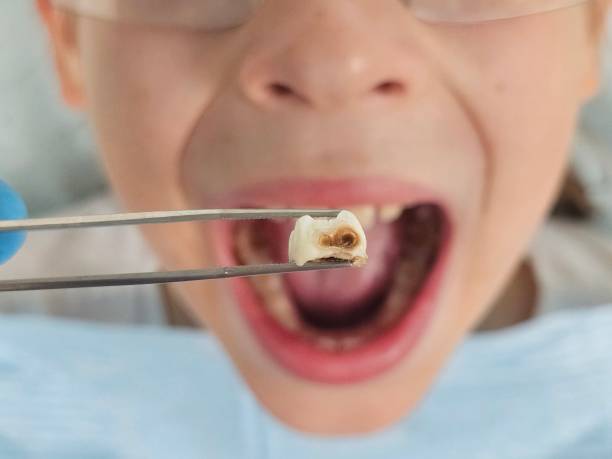 Best Urgent Dental Care for Toothaches in Concord, VA
