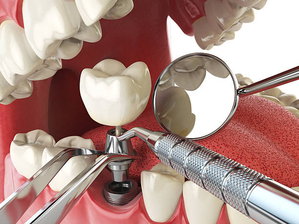 Best Emergency Treatment for Jaw Pain or Injury in Concord, VA